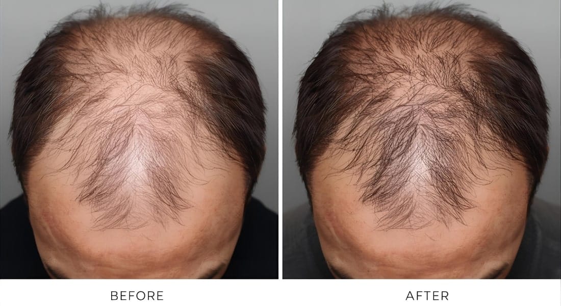 Advanced Solutions for Healthy Hair Growth